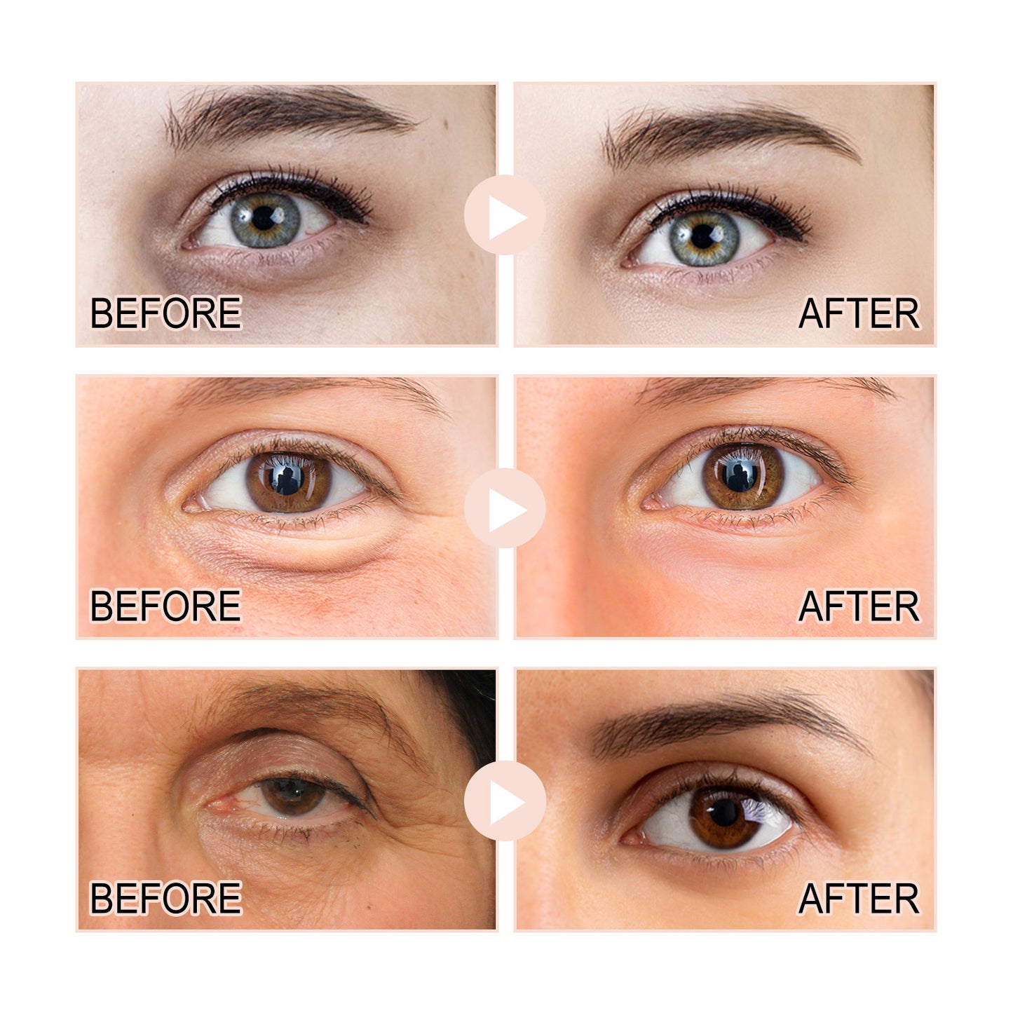 Retinol Eye Corner Fine Lines